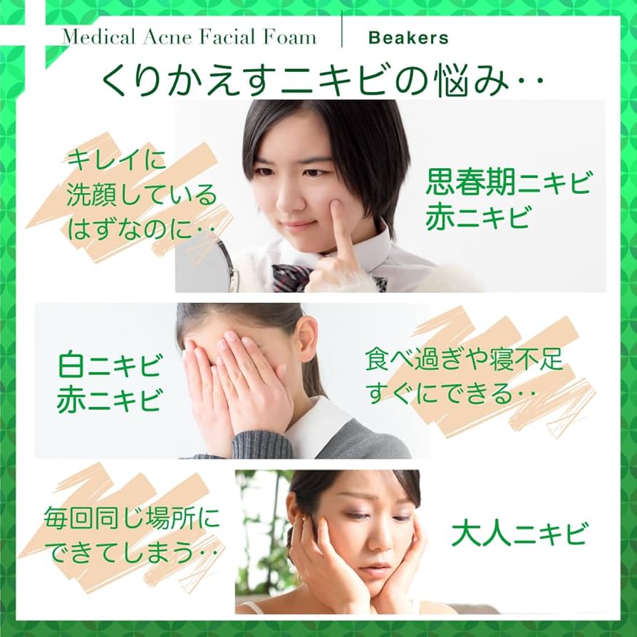 Amazon | 【医薬部外品】薬用 洗顔フォーム 120g ニキビ対策
